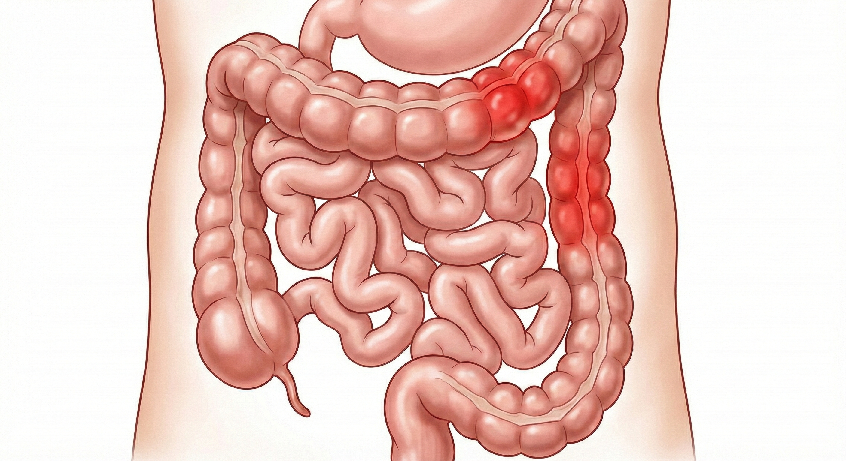 Intestinal & Colorectal Surgery